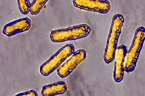 Vi khuẩn Listeria liên quan đến thực phẩm chế biến sẵn