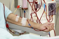 Suy thận trẻ hóa, nguy cơ đáng lo từ lối sống thiếu khoa học