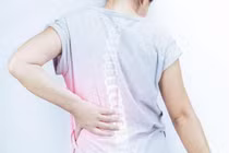 Thoát vị đĩa đệm âm thầm tấn công người trẻ