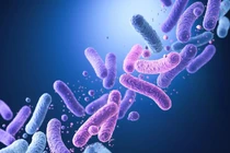 Độc tố trong sữa Aptamil First Infant Formula bị thu hồi nguy hiểm sao?