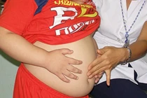 TP HCM gia tăng tỷ lệ trẻ béo phì 