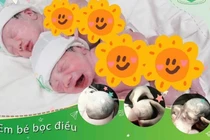 Ca sinh đôi đặc biệt, một bé chào đời còn nguyên trong bọc ối