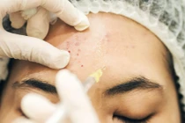 Công ty TNHH Falm Asia bị phạt 38 triệu đồng vì vi phạm quảng cáo y tế