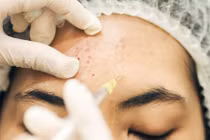 Công ty TNHH Falm Asia bị phạt 38 triệu đồng vì vi phạm quảng cáo y tế