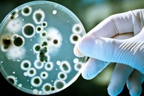 Dịch bệnh tả trên toàn cầu gia tăng, Bộ Y tế khuyến cáo 