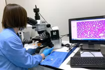 Xét nghiệm máu có thể phát hiện sớm nhiều loại ung thư