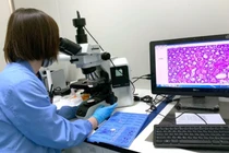 Xét nghiệm máu phát hiện ADN ung thư sớm trước 3 năm