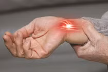 Phát hiện sớm hội chứng ống cổ tay, tránh tổn thương lâu dài