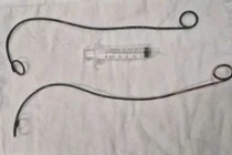 Phẫu thuật lấy 2 ống thông JJ bị bệnh nhân 'bỏ quên' trong người hơn 10 năm