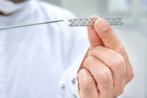 Đặt stent, cứu sống nhiều bệnh nhân nhồi máu cơ tim nguy kịch 