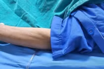 Bệnh nhân 71 tuổi ở Ninh Bình bị ong vò vẽ đốt biến chứng suy đa tạng