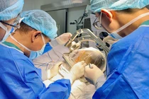 Đặt điện cực não sâu, phẫu thuật cứu thiếu nữ bị động kinh kháng thuốc