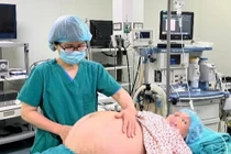 Mổ đẻ thành công ca mang song thai bằng IVF ở tuổi 52