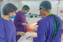 Tái tạo thực quản bằng đại tràng cho bệnh nhân 51 tuổi ung thư 