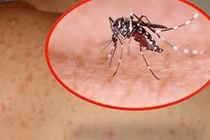 Hà Nội ghi nhận 190 trường hợp mắc sốt xuất huyết trong tuần qua