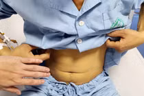 Uống mật cá trắm tăng sinh lý, người đàn ông ở Thanh Hóa bị ngộ độc nguy kịch