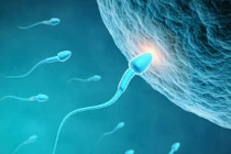 Người hiến tinh trùng mang đột biến gene gây ung thư là cha của gần 200 trẻ