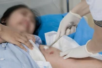 Bé gái ở Phú Thọ bị chó hàng xóm cắn phải nhập viện 