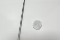 Bé trai gần 4 tuổi bị nghẹt mũi, sốt cao do 'nắp lọ thuốc' nằm trong mũi