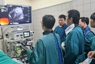 Phát hiện sớm ung thư tiêu hóa nhờ nội soi siêu âm