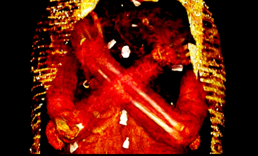 "Nội soi" xác ướp Ai Cập, bàng hoàng thấy 49 lá bùa hộ mệnh