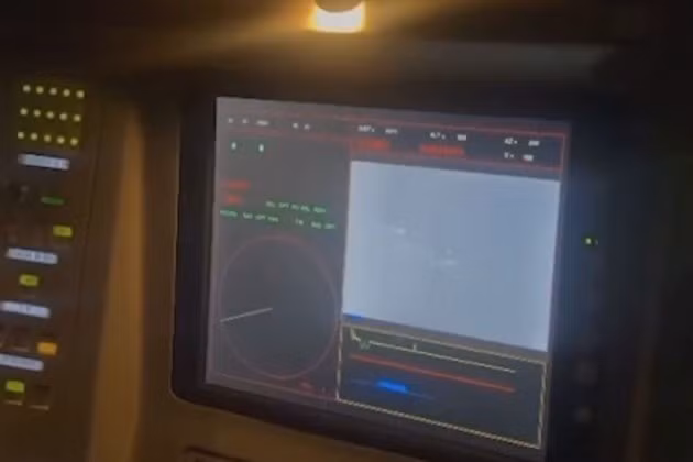  Hệ thống phòng không S-300 thời Liên Xô, vẫn đang được Ukraine sử dụng, có tầm bắn xa hơn nhưng lại gặp khó khăn trước UAV hiện đại, do hệ thống radar lạc hậu. Với thiết kế nhỏ gọn và thời gian chuyển thế chiến đấu từ thế hành quân sang chiến đấu nhanh của Crotale chỉ có năm phút, làm cho nó trở thành vũ khí phòng không lý tưởng, để bảo vệ các đơn vị cơ động và khu vực đô thị; một sự linh hoạt mà các hệ thống lớn hơn không thể sánh kịp.