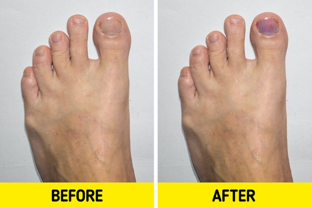 Cơ thể thay đổi đáng kinh ngạc khi chạy bộ Co the thay doi dang kinh ngac khi chay bo