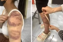 Kẻ bạo hành vợ mang thai và con gái 13 tuổi có thể đối mặt mức án nào?