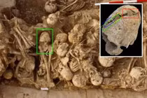 "Nội soi" hộp sọ 6.200 tuổi, sốc nặng cái chết của chủ nhân