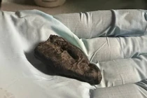 Bí ẩn thiếu nữ tuổi teen nhai 'kẹo cao su' hơn 10.000 năm trước