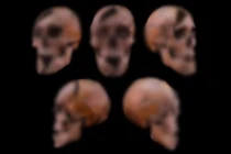 'Nội soi' hài cốt Công tước Hungary hé lộ cái chết tàn bạo