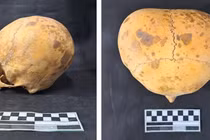  Sửng sốt hộp sọ người lạ 700 năm tuổi ở Argentina