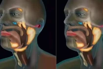 Phát hiện cơ quan mới trong cơ thể người