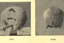 Căn bệnh "lạ" khiến pharaoh Ai Cập thành người khổng lồ