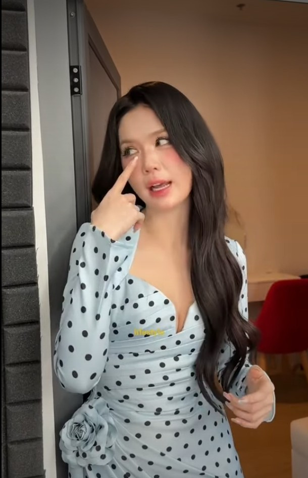 Thay vì né tránh, "nữ hoàng nội y" công khai thừa nhận bản thân từng can thiệp thẩm mỹ nhằm duy trì vẻ ngoài hiện tại.