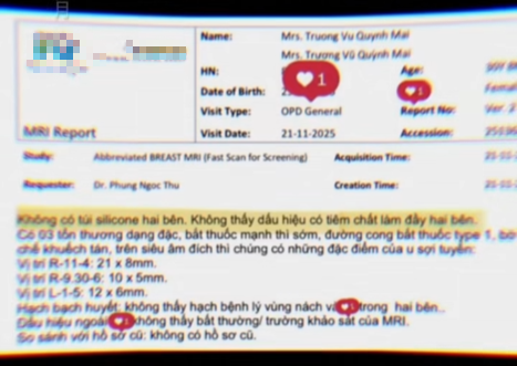 Sự việc nhanh chóng lan rộng khi một bình luận mang tính mỉa mai xuất hiện, ám chỉ rằng vòng một của cô nàng trông “không thật”. Dù chỉ là một câu nói mang tính kích động, nó lại thu hút không ít ý kiến trái chiều và vô tình tạo thành làn sóng nghi ngờ về ngoại hình của nữ MC.