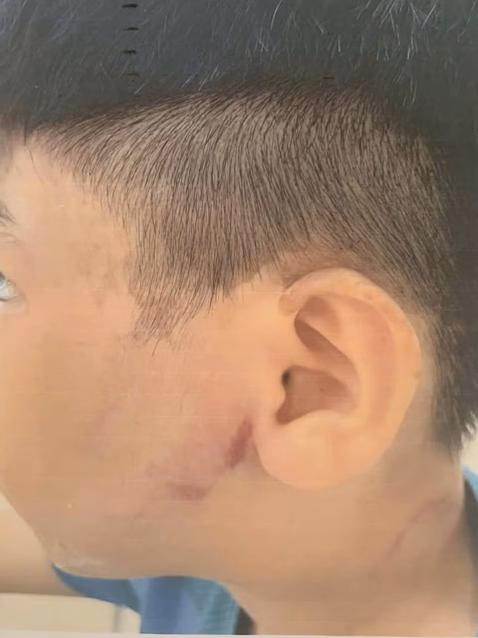 Công an xã Đông Thạnh đang xác minh vụ bé trai 8 tuổi nghi bị cha ruột đánh.