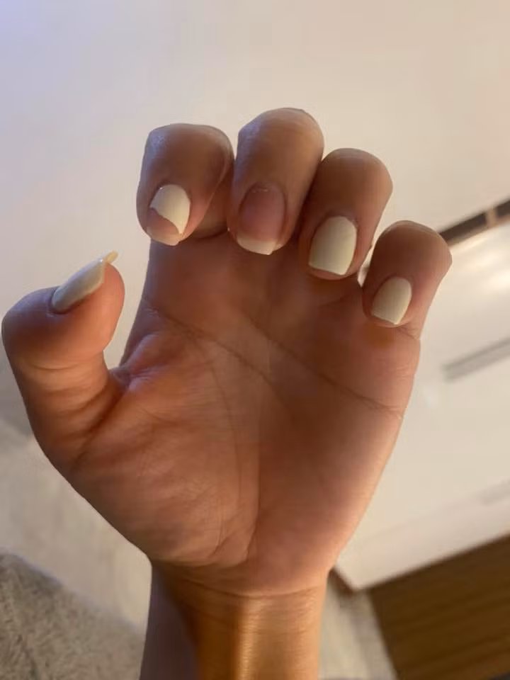 Các chuyên gia làm nail cũng khuyên chị em không nên tự cạy hoặc bóc móng tại nhà, dù là sơn thường, gel hay móng úp. Việc gỡ sai cách dễ làm bong lớp keratin tự nhiên, khiến móng mỏng, sần trắng và dễ gãy hơn. Tốt nhất, hãy đến tiệm để thợ dùng dung dịch chuyên dụng và dụng cụ đúng kỹ thuật, giúp tháo móng an toàn, giữ nền móng khỏe.