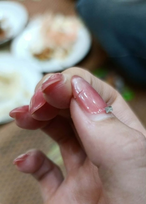 Nếu trước Tết là “đại hội làm nail” thì sau Tết lại rộ lên “đại hội tháo móng”. Trên mạng xã hội, nhiều chị em đăng ảnh đôi tay ngay sau khi gỡ lớp gel, lớp móng úp. Bề mặt móng lúc này thường xuất hiện những mảng trắng sần, dấu vết rõ rệt của keo và sơn vừa được loại bỏ. Nhìn vào là biết ngay hành trình dưỡng móng sắp bắt đầu để móng khỏe và bóng trở lại.