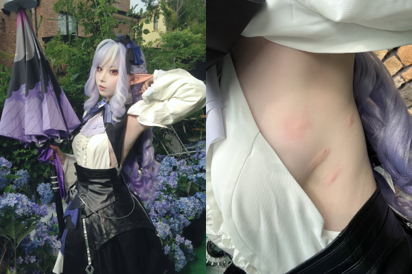 Có thể thấy rõ vài nốt sưng đỏ, thậm chí có vết đã bị trầy nhẹ do gãi. Rõ ràng, nữ coser này đã phải chịu đựng hàng loạt "đợt tấn công" trong suốt quá trình tham dự sự kiện.