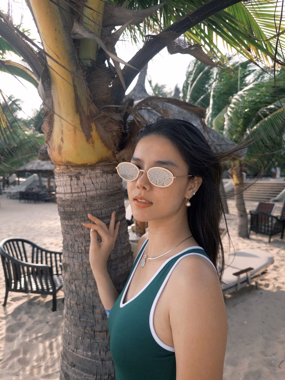 Sau phẫu thuật, Kỳ Hân phải di chuyển bằng xe lăn, sau đó tập đi với nạng, kết hợp vật lý trị liệu tích cực.