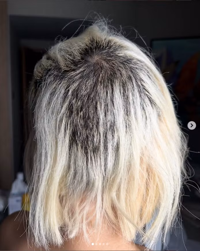 Nữ DJ hot nhất châu Á cho biết, salon đã để hóa chất quá lâu, khiến tình trạng tóc trở nên tồi tệ đến mức cô phải cạo bỏ hoàn toàn phần tóc phía sau và hai bên đầu.