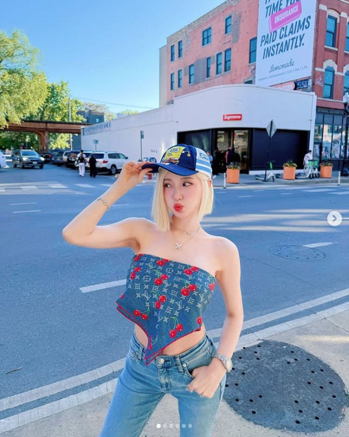 SODA cũng bày tỏ sự đau lòng khi xem lại những video biểu diễn mà người hâm mộ quay, bởi những mảng tóc hói hiện rõ.