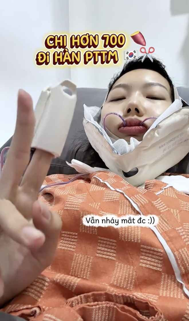 Cụ thể, người đẹp sinh năm 1998 lựa chọn gọt hàm và nâng ngực tại Gang Nam (Hàn Quốc). Kết quả mang lại vượt xa kỳ vọng khi gương mặt Yuna Vũ sau phẫu thuật trở nên đầy đặn, mềm mại và nữ tính hơn.