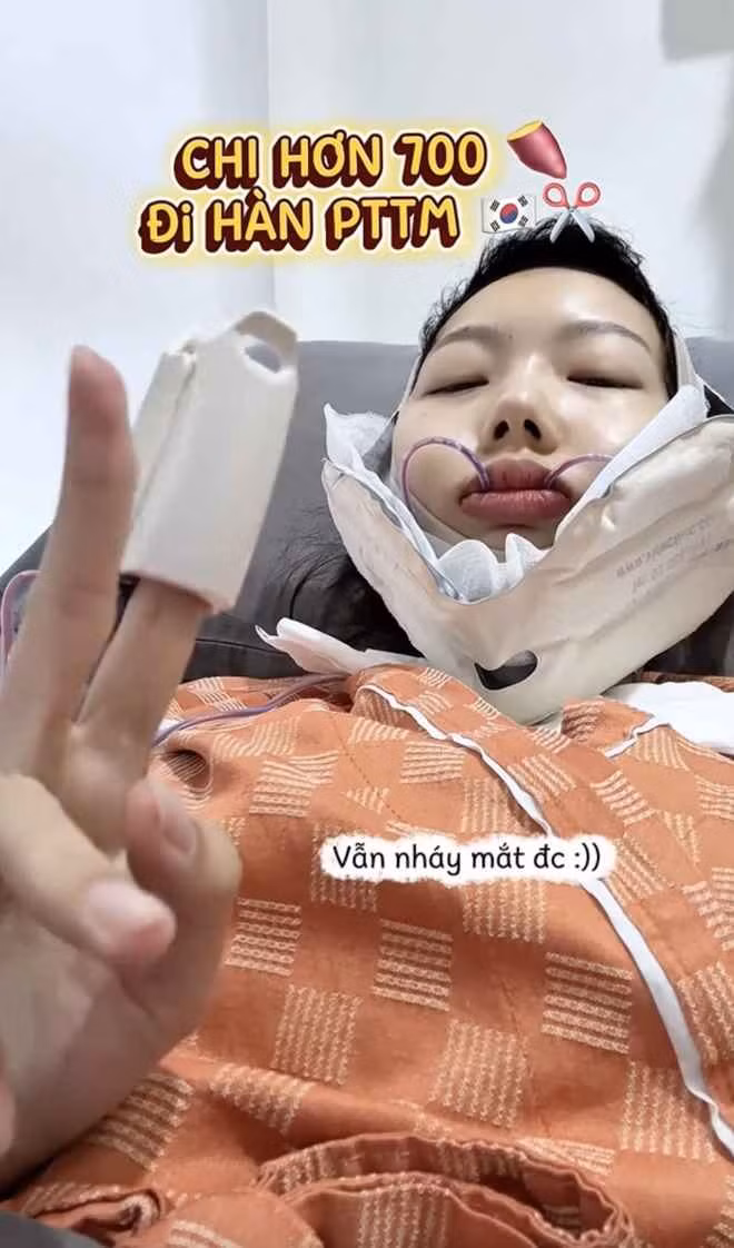 Cụ thể, người đẹp sinh năm 1998 lựa chọn gọt hàm và nâng ngực tại Gang Nam (Hàn Quốc). Kết quả mang lại vượt xa kỳ vọng khi gương mặt Yuna Vũ sau phẫu thuật trở nên đầy đặn, mềm mại và nữ tính hơn.