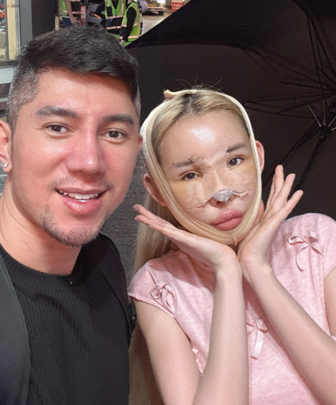 Vào tháng 8/2024, Ngân 98 từng cho biết quyết định phẫu thuật vì muốn sửa nét trên gương mặt hiền hơn. Cô đã chi hơn 1 tỷ đồng sang Hàn Quốc để có gương mặt tự nhiên và trẻ trung.