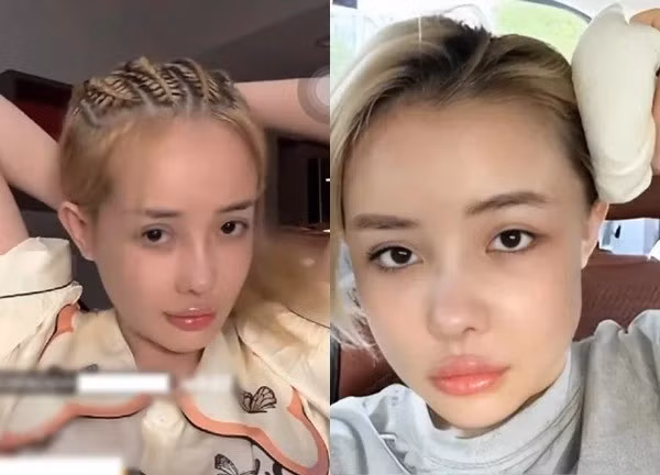 Tuy nhiên, đến hiện tại sau khi trải qua "7749" lần thẩm mỹ, Ngân 98 khiến netizen ngao ngán vì nhan sắc ngày càng biến dạng vì gặp nhiều biến chứng sau chỉnh sửa.