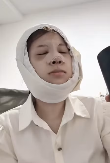 Trong một dịp có cơ hội lên sóng truyền hình, không thể can thiệp mềm chỉnh sửa cũng như chủ động góc mặt, hot girl TikTok nhận ra có nhiều góc chưa đẹp lộ ra. Và cô nàng quyết định thay đổi.