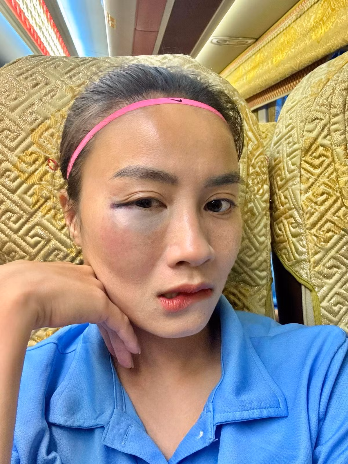 Trước đó, vào tháng 9/2025, trên trang cá nhân cầu thủ Hoàng Thị Loan chia sẻ khoảnh khắc sau trận đấu khai màn giải bóng đá nữ vô địch quốc gia chiều ngày 4/9 trên sân PVF. Vùng mắt của cô sưng vù và bầm tím.