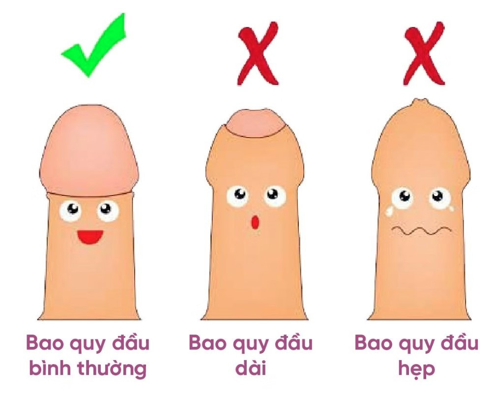 Ảnh minh họa nguồn Internet - Ảnh BVCC bao-quy-dau-1.jpg